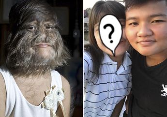 Alami Sindrom Langka Wajah Wanita ini Ditutupi Rambut, Intip Potret Manisnya saat Bulunya Dicukur!