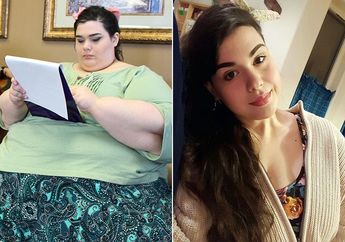 Perubahan Drastis Wanita Obesitas Seberat 300 Kg Setelah Kurus, Bikin Pangling!