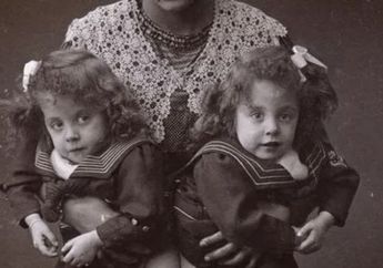 Kisah Tragis Daisy & Violet Hilton, Anak Kembar Siam yang Diperalat Menjadi Budak Pencari Uang 