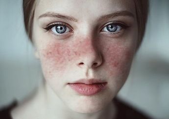 Waspada 5 Penyakit ini Rawan Menyerang Kamu di Usia 20-an