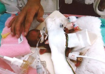 Terlahir dengan Berat yang Sangat Kecil, Lihat Keajaiban yang Dialami Oleh Bayi Prematur Ini