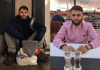 Pura-pura Jadi Gelandangan, Milyuner Tampan ini Hampir Terbunuh Gara-gara Miliki Gigi Putih Seharga Rp 73 Juta