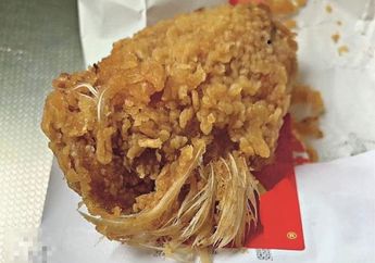 Seorang Ibu Kaget Temukan Bulu di Balik Ayam Krispi dari Sebuah Restoran Cepat Saji 