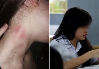 Seorang Ibu Curiga Lihat 'Cupang' di Leher Putrinya, Setelah Diinterogasi Sang Putri Akhirnya Mengaku Telah Melakukan Hal Ini dengan 5 Pria