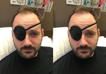 Meretakkan Leher agar Rileks, Pria Ini Alami Stroke Karena Arteri Vertebratanya Sobek hingga Dilarikan ke ICU!