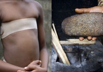 Para Gadis di Kamerun Lakukan Tradisi Setrika Payudara Untuk Hindari Pelecehan Seksual!