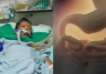 Ngeri! Usus Wanita ini Hancur Akibat Konsumsi Teh Pelangsing Tak Sesuai Aturan