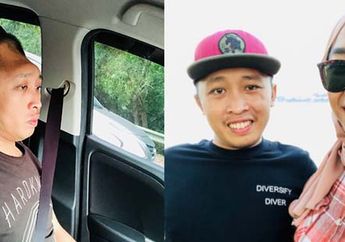 Alami Kecelakaan Hebat, Pemadam Kebakaran ini Harus Kehilangan Separuh Kepalanya