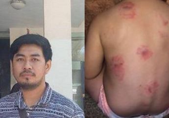 Bayi 3 Bulan Tewas di Tempat Penitipan Anak dengan Tangan dan Mulut Membiru, Penyebab Kematian Belum Terungkap