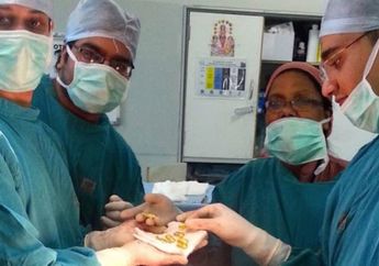 Mengeluh Sulit BAB, Dokter Terkejut Saat Temukan 12 Batang Emas dalam Perut Pasiennya