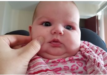 Hentikan! Jangan Suka Mencubit Pipi Bayi Jika Tak Mau Kena Dampak Berbahaya Ini!