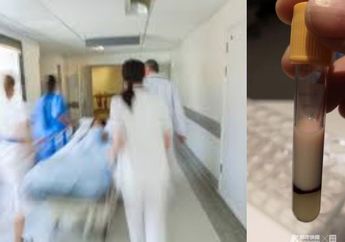 Miliki Kebiasaan Merokok yang Parah, Darah Pasien ini Menggumpal Seperti Susu dan Terancam Mati