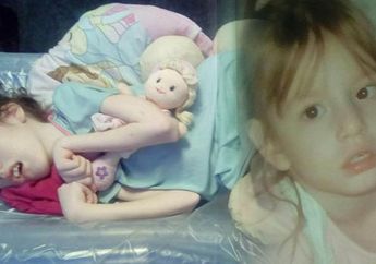 Terlahir Cantik dan Sehat, Akibat Kelalaian Orangtua Gadis Kecil ini Justru Lumpuh Total
