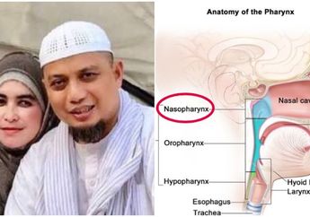 Berkaca dari Ustaz Arifin Ilham, Makanan Murah Meriah Favorit Masyarakat Indonesia ini Bisa Jadi Pemicu Kanker Nasofaring