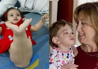 3 Kondisi Medis Misterius yang Masih Menjadi Misteri di Dunia Kedokteran