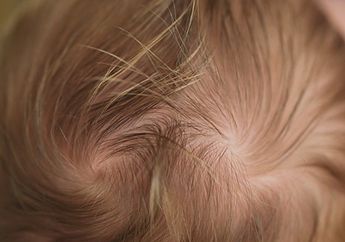 Bukan Nakal, Ini Kepribadian Anak yang Punya Dua Unyeng-unyeng di Kepala, Berkut Fakta Cowlicks yang Bisa Jadi Indikasi Kondisi Buruk