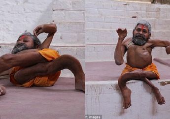 Alami Kondisi Medis Aneh Hingga Tulangnya Bengkok, Pendeta ini Justru Mengaku Hidup Bahagia