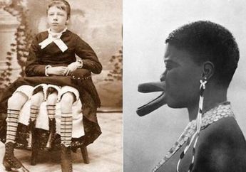 Kisah Manusia Unik yang Hidup di Balik 'Penjara Sirkus' Untuk Dipertontonkan