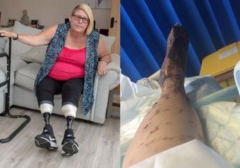 Ngeri! Kakinya Berubah Jadi Hitam dan Diamputasi Karena Miningitis, Ketahui Gejalanya Berikut ini!