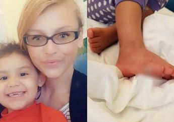 Waspada! Balita ini Terkena Infeksi Mematikan Usai Mencoba Sepatu di Toko Tanpa Kaus Kaki