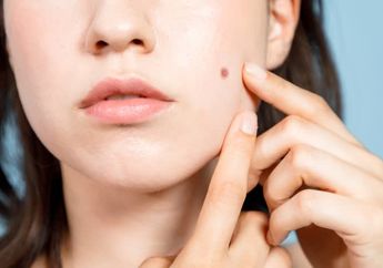 Cuan Bakal Ngalir Terus, Inilah Letak Tahi Lalat yang Dianggap Membawa Keberuntungan di Masa Depan, Cek Yuk!