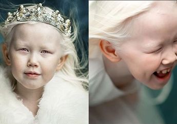 Nariyana, 'Putri Salju' dari Siberia yang Menarik Perhatian Dunia Modelling