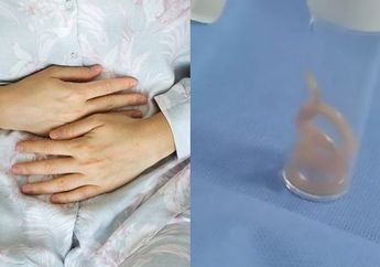 10 Tahun Alami Sakit Perut, Dokter Dapati Hewan Mengerikan ini Melata dalam Ususnya