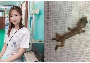 Viral di Facebook, Seorang Dokter Muda Terkejut Temukan Cicak Hidup di Telinga Pasien