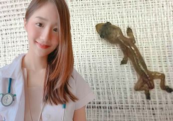 Baru Hari Pertama Bekerja, Dokter Cantik ini Justru Temukan Tokek Hidup dalam Kuping Pasiennya