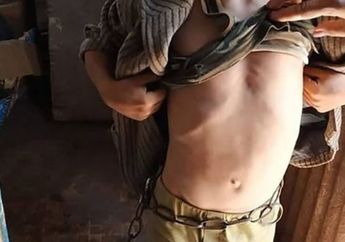 Miris, Anak 6 Tahun Diikat dengan Rantai oleh Ayah Kandungnya, Polisi Juga Temukan Bekas Penyiksaan di Tubuh si Bocah