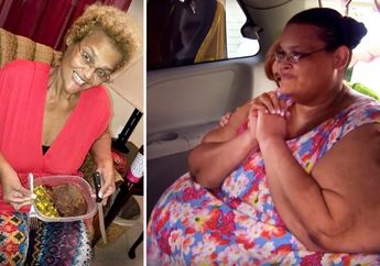 Alami Pembengkakan Kaki, Wanita Ini Berhasil Turunkan Berat Badan dari 340 Kg Jadi 70 Kg