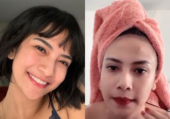 Vanessa Angel Lakukan Perawatan Wajah, Netizen Malah Salah Fokus dengan Dahinya! Kenapa?
