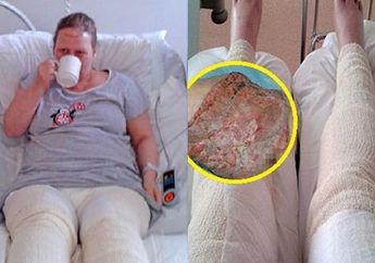 Wanita ini Koma 9 Hari dan Nyaris Meninggal Usai Cukur Bulu Kemaluannya