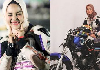 Berawal dari Behel, Gigi Pembalap Cantik ini Ompong dan Ternyata Kanker!