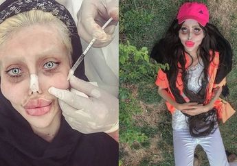 Terobsesi Miliki Wajah Mirip Angelina Jolie hingga Nekat Lakukan Operasi Sebanyak 50 Kali, Begini Kabar Wanita Ini Sekarang!