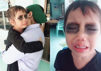 Viral, Kena Usil Ibunya saat Tidur, Bocah Ini Tak Berhenti Menangis Lihat Matanya Menghitam