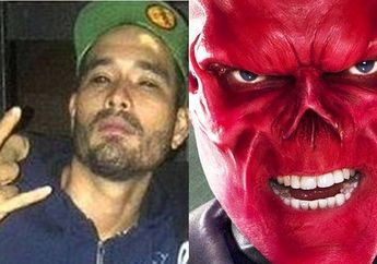 Terobsesi Jadi Red Skull, Pria ini Nekat Potong Hidungnya Hingga Tumbuhkan Benjolan di Kepala!