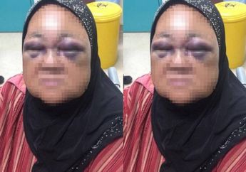 Nenek 69 Tahun Terancam Buta Usai Ditonjok Cucunya Sendiri karena Masalah Sepele