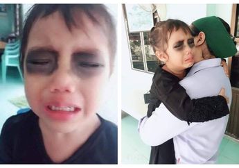 Viral Prank Hitamkan Mata Anak yang Kecanduan Gadget, Ahli Kesehatan Peringatkan Dampak Psikis ke Buah Hati