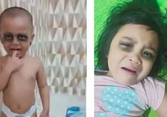 Viral Video Area Mata Anak Hitam Guna Jera dengan Ponsel, Benarkah Cara Tersebut?