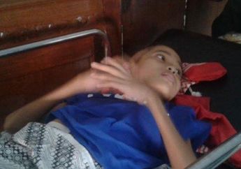 Kisah I Nyoman Dharma Sukerta, Bocah 12 Tahun yang Kakinya Diamputasi Karena Kanker Tulang