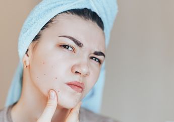 Pilihan Skincare Murah untuk Mengatasi Jerawat, Rp 20 Ribuan Aja!