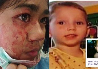 4 Kondisi Medis Langka di Dunia, Dari Nangis Darah Hingga Anak yang Tak Bisa Tidur 24 Jam Selama Setahun!