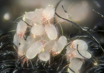 Ampuh Hilangkan Kotoran Tungau, Ini Bahan Dapur yang Kupas Tuntas Penyebab Alergi di Rumah