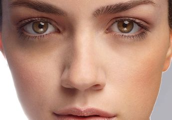 Waspada, Lingkaran Hitam di Bawah Mata Ternyata Bisa Menandakan 4 Penyakit ini