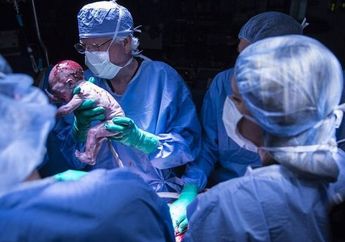 Lihat Tangan Bayinya Terputus di Dalam Rahim, Ibu Ini Sempat Ingin Bunuh Diri, Kondisi Bayi Tersebut Kini Sungguh Menakjubkan