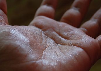 Sering Dianggap Tanda Jantung Lemah, Benarkah Telapak Tangan Berkeringat Pertanda Adanya Gangguan Kesehatan?