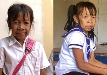 Baru Berusia 10 Tahun, Bocah SD Ini Keriput dan Tampak Seperti Nenek 60 Tahun Sampai Disebut Punya Karma dari Kehidupan Masa Lalunya
