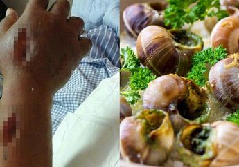 Tubuh 2 Wanita ini Tiba-Tiba Membengkak dan Meninggal Usai Makan Seafood