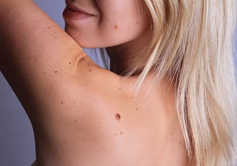 Punya 5 Tanda ini Pada Bagian Tubuh? Selamat, Tandanya Kamu adalah Orang yang Beruntung!